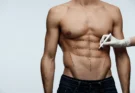 Tips for Preparing for Extended Tummy Tuck Surgery Safely